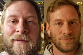 Kasutamise kogemus Alkotox Gerard välja Marcel